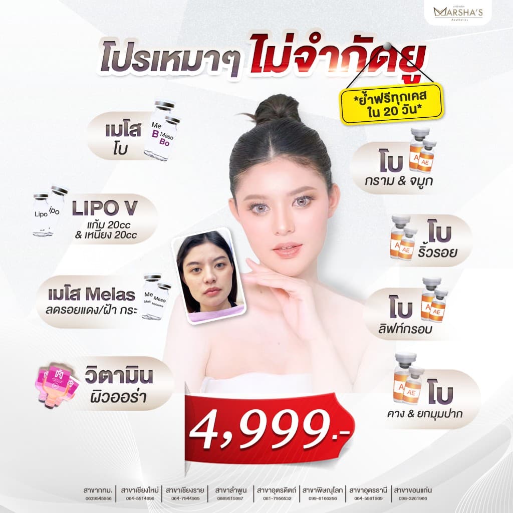 โปรเหมาๆ ไม่จำกัดยู 4,999